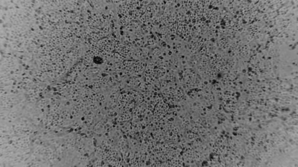 호주에서 배양한 신종 코로나바이러스사진. 질병관리본부는 5일 국내에서도 환자로부터 바이러스를 분리하는데 성공했다고 밝혔다. [사진=뉴시스]