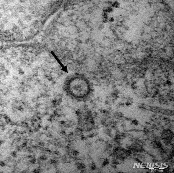 [ 질병관리본부는 6명의 신종 코로나바이러스 감염증(코로나19) 환자로부터 얻은 코로나19 바이러스(SARS-CoV-2)의 고해상 전자현미경 사진을 공개했다 / 사진 = 뉴시스 ]